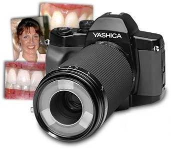 Yashica Dental-Eye III